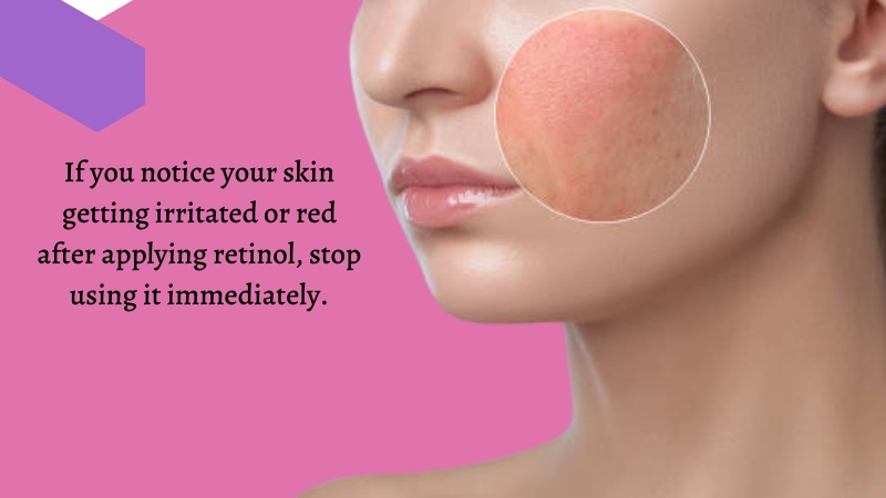 10-Benefits of Retinol for a Glowing Skin