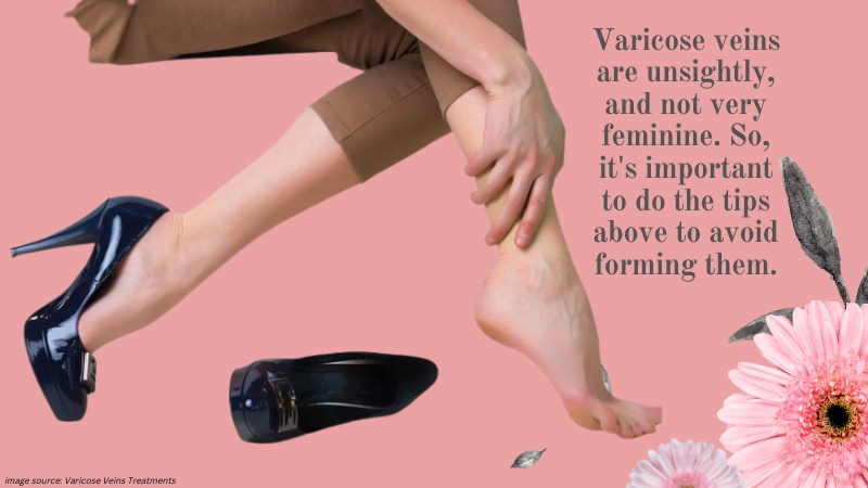 6 Tips For Avoiding Varicose Veins As A Crossdresser