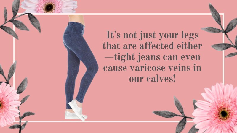 6 Tips For Avoiding Varicose Veins As A Crossdresser